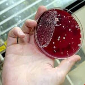 کیت هورمونی